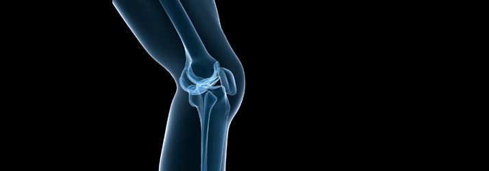 Knee Pain Knee Pain