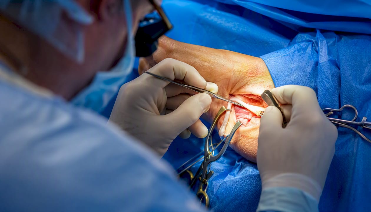 Surgeon working on posterior tibial tendon repair