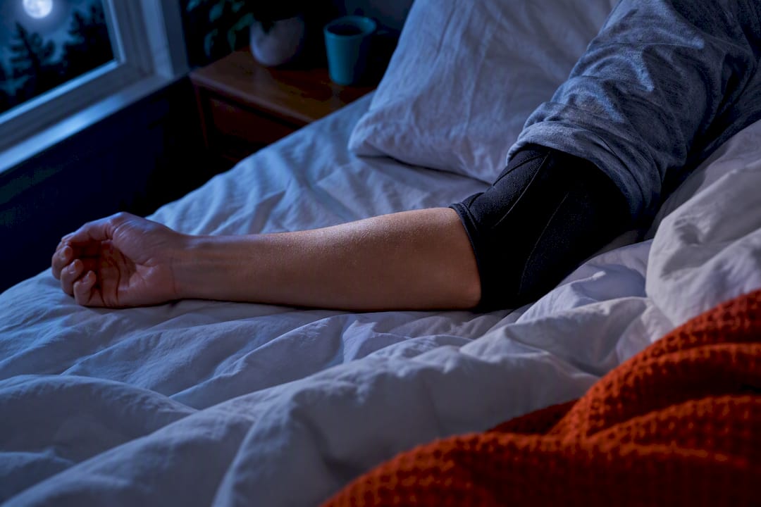 Why Night Splints Work 89% for Cubital Tunnel Syndrome Treatment