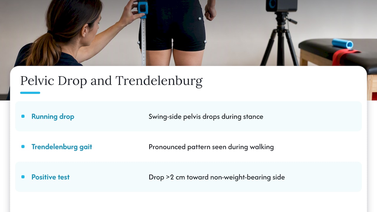 What hip drop is, and how it relates to Trendelenburg gait — overview diagram